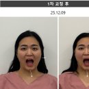 대화한의원 | 수원안면비대칭 교정한의원 수원턱관절 교정 후기