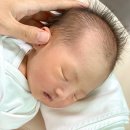 유전제1농로 | 신생아 눈을 거의 안 뜬다면? 안검하수 진단부터 희귀 유전질환 KAT6B까지