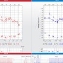 서울보청기상사 이미지