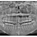 명 치과기공소 이미지