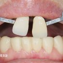 이도치과기공소 이미지