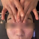 아름홈케어 | 창원에스테틱 문제성피부관리 여드름피부관리 아름에스테틱 후기✨