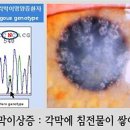 (주) 루미아이제네틱스