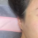 기브미의원 | 강남역 피부과 추천 레이저토닝 후기! [기브미의원]