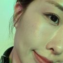 써니25 | 써니리프팅 내돈내산 솔직후기! 효과 / 통증 / 팁 비교 / 전후 비교 / 써마지 차이 (ft. 압구정 피부과...
