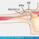 오른쪽 왼쪽 어깨 통증 원인 이미지