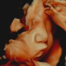 노산 임신준비[21] 30W 광명미래여성산부인과 2차 정밀초음파 성공으로 아기얼굴 본 후기