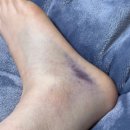 국군함평치과병원 | [제6편] 군병원 치료 후기 &amp; 실용 꿀팁