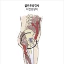 타이트짐 이미지