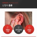 밝은보청기 이미지