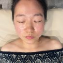 이레 솔루션 | 당진에스테틱 이레뷰티 솔직후기