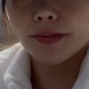 거금의원 | [수지구청역 피부과]세르프300샷+프리미엄리쥬란 내돈내산 시술 후기/셀린의원 용인수지점