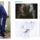 SPOREC 네이버블로그