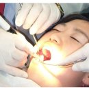 치과병원과 "무증상 감염자"들 이미지