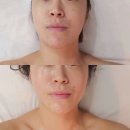 노원피부관리 사심뷰티에스테틱 후기 (탈리온에 진심인 사장님)