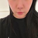 원정(통안)경로당 | 써마지 리프팅 600샷으로 얼굴 탄력관리한 전후 후기 비교