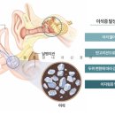 몸편한내과신경과의원 | 대구이석증, 신경과 진료도 <고려>해야 합니다