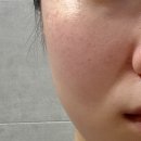 폼메디칼 | 조가비 아크컨트롤 카밍클렌징폼 l 찐 사용후기