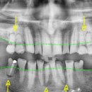 더플랜트치과의원 이미지