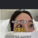 설블링