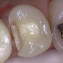 크라운치과의원 이미지