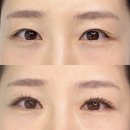 삭주로145번길2 | [의정부 속눈썹] 아망떼뷰티 하이 퀄리티 플랫모 JC 컬 속눈썹 연장(8~10mm) 리얼 후기