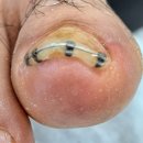 포시뷰티바 이미지