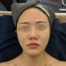 보문 웨딩관리 : 레아쥬 미세전류 테라피 리버스에이징 라운지 받아본 후기