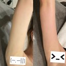 만세365병원 | 지방흡입후관리샵 바본관리 더올슬림 케어 후기