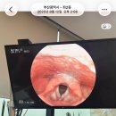 성대약국 - 순천시 팔마로 130-1 | 성대결절 10년차 영어강사의 눈물겨운 극복기... (진행중..)