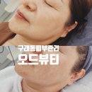 구래동 피부관리 고주파 탄력과주름 동시에관리 오드뷰티 진심후기