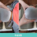 3D안면비대칭교정