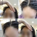 라브리지헤어살롱 동탄장지점 | 동탄 2미용실 /라브리지헤어 에서 유기농 헤어클리닉 관리받은 후기~♥