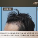 뉴웰성형외과의원 네이버블로그