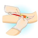 신장 기능 검사[renal function test] 이미지