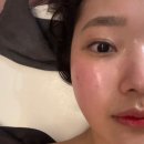 끌리메 | 상무지구 | 광주에스테틱 작은얼굴 후기 “끌리메 광주점”