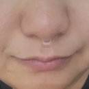 엠에스(M.S)메디컬 | 편안한 수면을 위한 HGG메디컬 비강확장기 사용 솔직후기