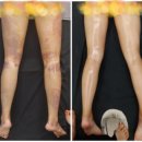 후스킨케어 이미지