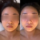 복산동-9 | 울산 중구 복산동 에스테틱 소통테라피 가인 작은얼굴관리 후기