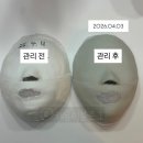 네오웰빙 | [W-32] 화명동 피부관리ㅣ약손명가 부산화명점ㅣ맞춤B관리ㅣ작은얼굴관리ㅣ신부관리ㅣ25회차 석고후기