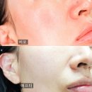 6514 | 코나피딜 그린박신 vs 그린박신 스트롱 차이점, 성분 , 사용방법 까지 내돈내산 후기