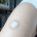 배내과의원 | 포진예방접종 싱그릭스 가격 차이 왜 이렇게 커요? 최저가 병원 찾은 방법 충주 윤호배 내과 실제접종후기