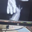 빠른후문약국 | 대구 w 병원 초진 진료부터 입원전검사 /입원수속/ 그리고 수술 /w병원 야외주차장 찾아가기 후기 1편