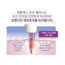 삼성미플러스의원 | [평택 피부과] 잇츠미의원 남성 제모 내돈내산 후기, 젠틀맥스 프로 플러스 가격/고통/관리