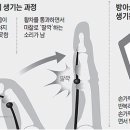 방아쇠 손가락 증후군 - 피부미용인의 직업 병 이미지