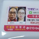 소망 인셀덤 이미지