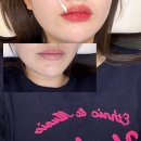 루미아스칼프 | 구미입술문신, 문성 루미아스칼프 립타투 한 달 후기