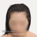 이미지헤어라인 | 마곡 헤어라인 문신 잘하는 곳, 이미지까지 바뀐다?