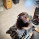 201-2-000004 | 가리봉동 가르마탈모 고민? 수원 율전동 모류교정 링거펌으로 단발 정수리 볼륨 되살린 후기