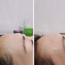 양재오라클피부과의원 이미지